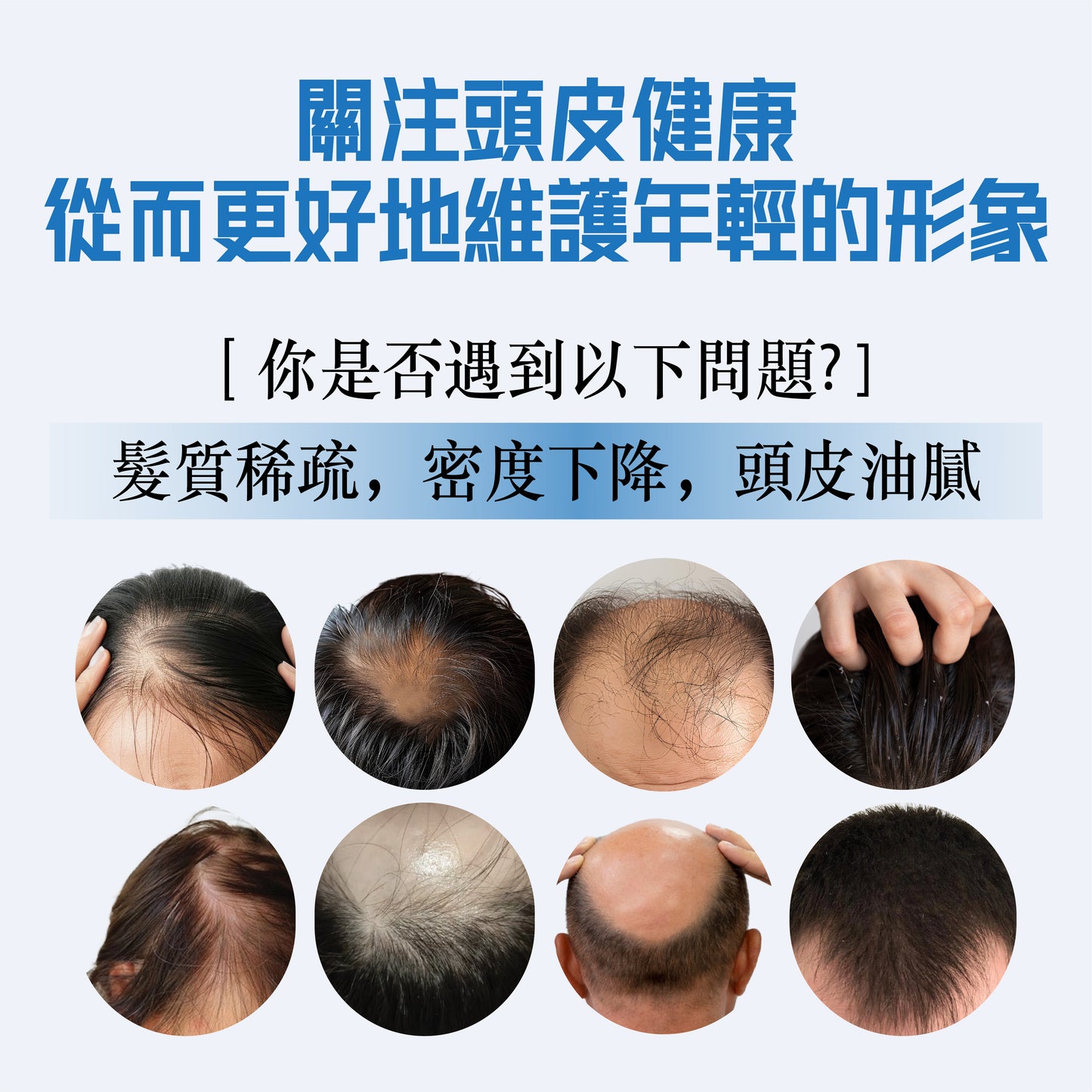 SalCium® 頭皮深層清潔洗髮精 110㎖ℯ